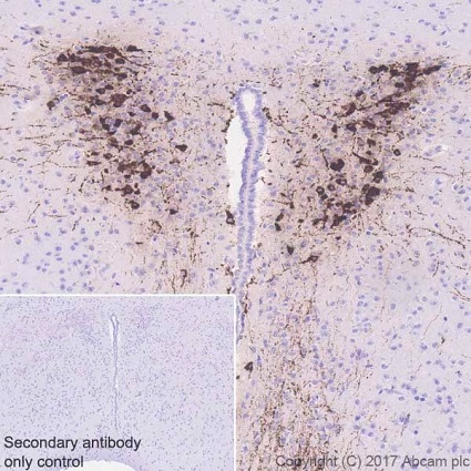 Immunohistochemistry (Formalin/PFA-fixed paraffin-embedded sections) - Anti-Vasopressin antibody [EPR20602] (AB213708), expandable thumbnail