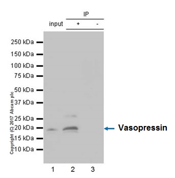 Immunoprecipitation - Anti-Vasopressin antibody [EPR20602] (AB213708), expandable thumbnail
