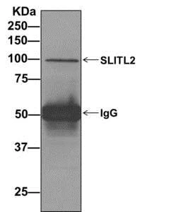 Immunoprecipitation - Anti-Vasorin antibody [EPR10901] (AB156868)