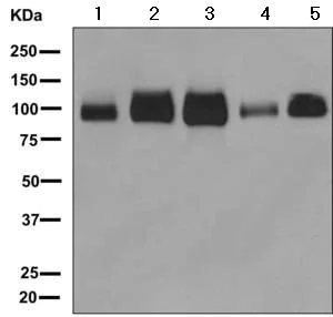 Western blot - Anti-Vasorin antibody [EPR10901] (AB156868)