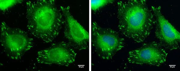 Immunocytochemistry/ Immunofluorescence - Anti-VASP antibody (AB229624)