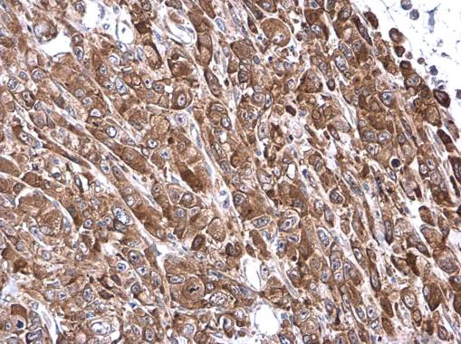 Immunohistochemistry (Formalin/PFA-fixed paraffin-embedded sections) - Anti-VASP antibody (AB229624)