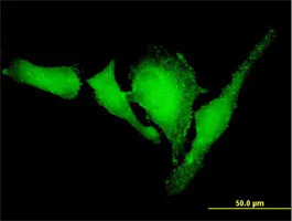 Immunocytochemistry/ Immunofluorescence - Anti-VASP antibody (AB89829)