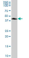Western blot - Anti-VASP antibody (AB89829)