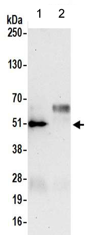 Immunoprecipitation - Anti-VASP antibody - C-terminal (AB205952), expandable thumbnail