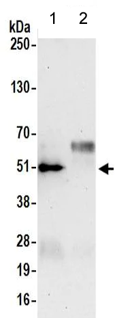 Immunoprecipitation - Anti-VASP antibody - C-terminal (AB205952)