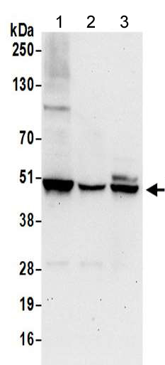 Western blot - Anti-VASP antibody - C-terminal (AB205952), expandable thumbnail