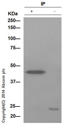 Immunoprecipitation - Anti-VASP antibody [EPR1337(2)] - BSA and Azide free (AB231823)