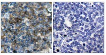 Immunohistochemistry (Formalin/PFA-fixed paraffin-embedded sections) - Anti-VASP (phospho S157) antibody (AB47268)