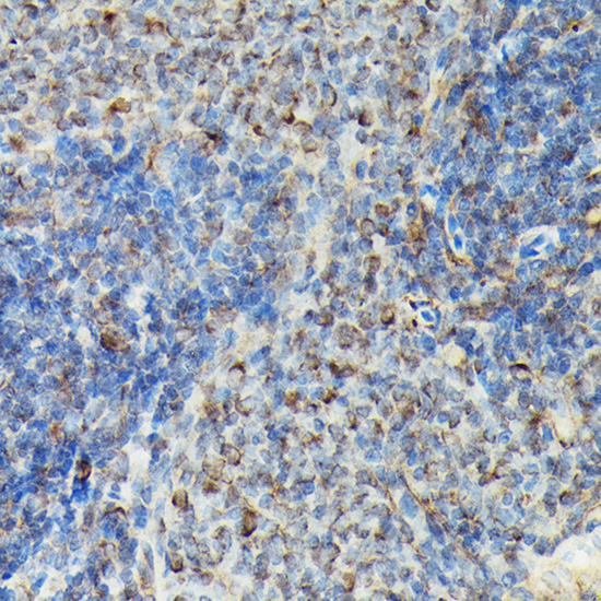 Immunohistochemistry (Formalin/PFA-fixed paraffin-embedded sections) - Anti-VASP (phospho S239) antibody (AB194747), expandable thumbnail