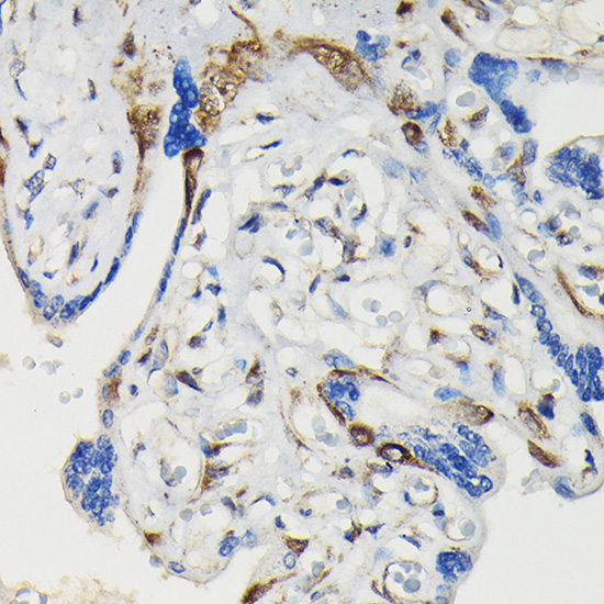 Immunohistochemistry (Formalin/PFA-fixed paraffin-embedded sections) - Anti-VASP (phospho S239) antibody (AB194747), expandable thumbnail