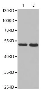 Western blot - Anti-VASP (phospho S239) antibody (AB194747)