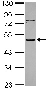Western blot - Anti-Vaspin antibody (AB101391)