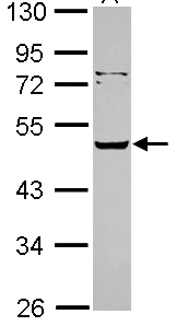 Western blot - Anti-Vaspin antibody (AB101391)