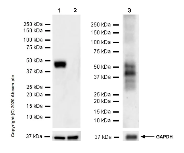 Western blot - Anti-Vaspin antibody [EPR23080-232] (AB267471)