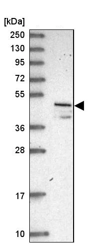 Western blot - Anti-VAT1 antibody (AB252999)