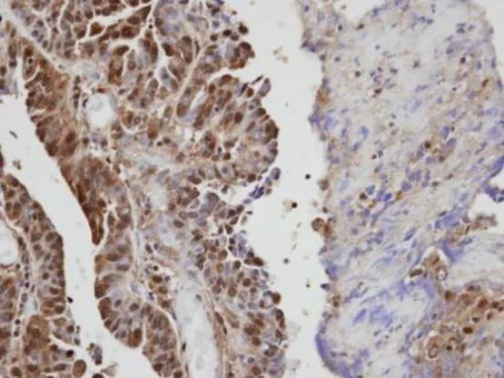 Immunohistochemistry (Formalin/PFA-fixed paraffin-embedded sections) - Anti-VAV1 antibody (AB97574)