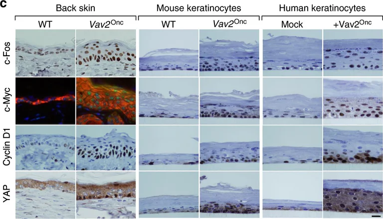 Immunohistochemistry - Anti-VAV2 antibody [EP1067Y] (AB52640)