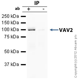 Immunoprecipitation - Anti-VAV2 antibody [EP1067Y] (AB52640)