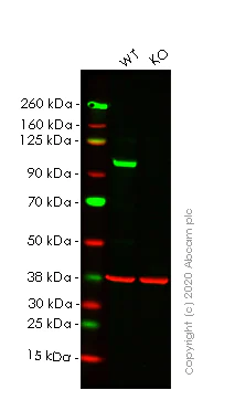 Western blot - Anti-VAV2 antibody [EP1067Y] (AB52640)