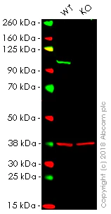 Western blot - Anti-VAV2 antibody [EP1067Y] (AB52640)