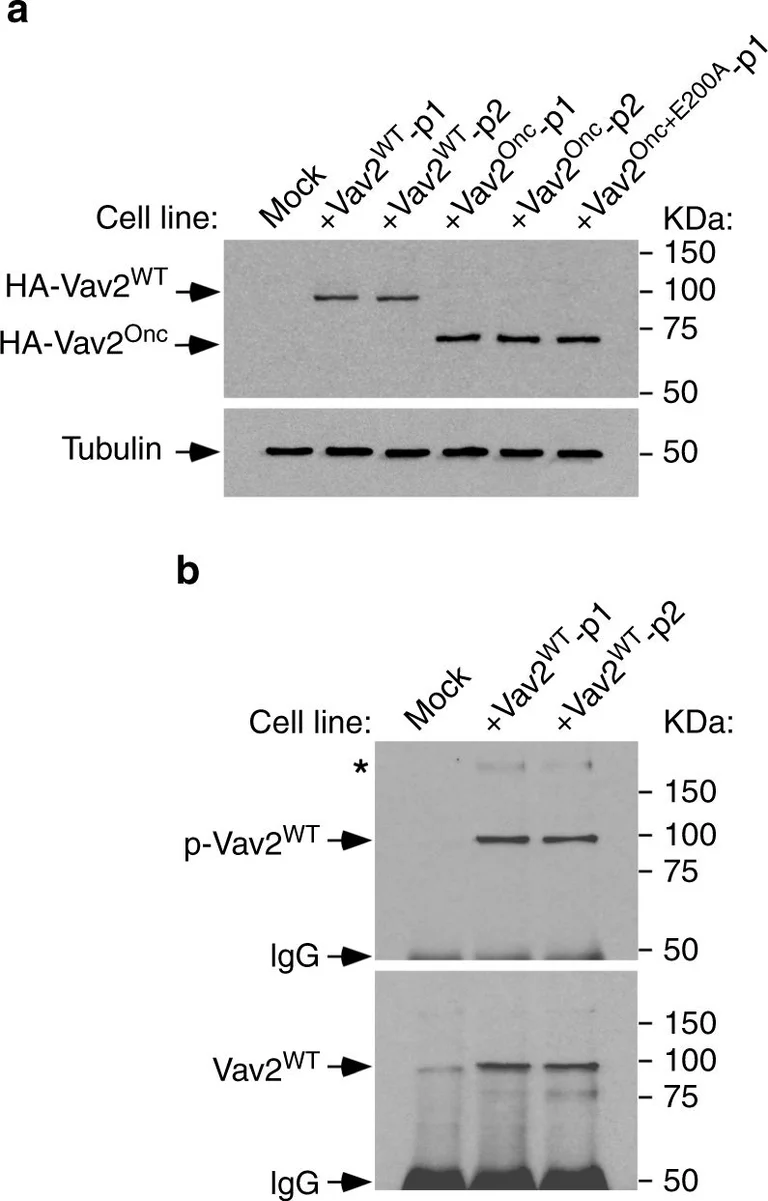 Western blot - Anti-VAV2 antibody [EP1067Y] (AB52640)