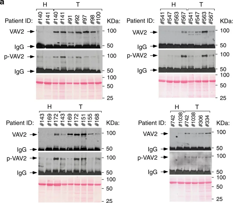 Western blot - Anti-VAV2 antibody [EP1067Y] (AB52640)