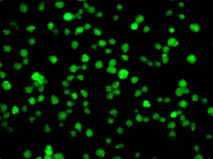 Immunocytochemistry/ Immunofluorescence - Anti-VAX2 antibody [EPR10424] (AB154855)