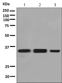 Western blot - Anti-VAX2 antibody [EPR10424] (AB154855)