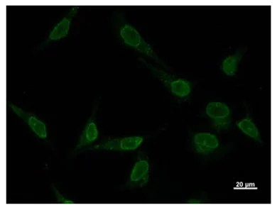 Immunocytochemistry/ Immunofluorescence - Anti-VAX2 antibody [VAX2A8F12] (AB50899)