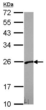 Western blot - Anti-VBP-1 antibody (AB96085), expandable thumbnail