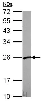 Western blot - Anti-VBP-1 antibody (AB96085)