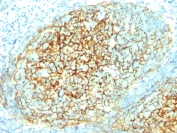 Immunohistochemistry (Formalin/PFA-fixed paraffin-embedded sections) - Anti-VCAM1 antibody [1.4C3] - BSA and Azide free (AB212937)