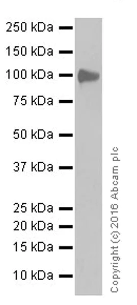 Western blot - Anti-VCAM1 antibody [EPR17010-83] (AB181315)