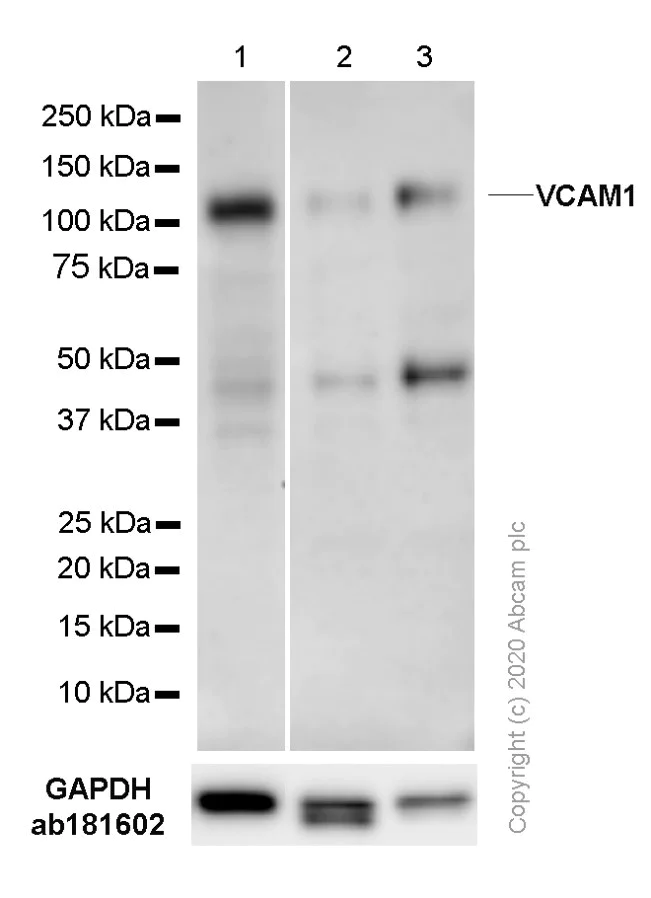 Western blot - Anti-VCAM1 antibody [EPR17010-83] (AB181315)