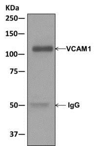 Immunoprecipitation - Anti-VCAM1 antibody [EPR5038(2)] (AB174279), expandable thumbnail
