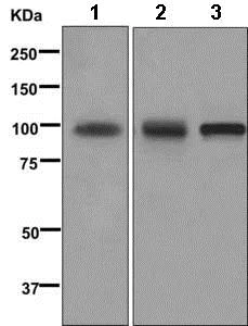 Western blot - Anti-VCAM1 antibody [EPR5038(2)] (AB174279)