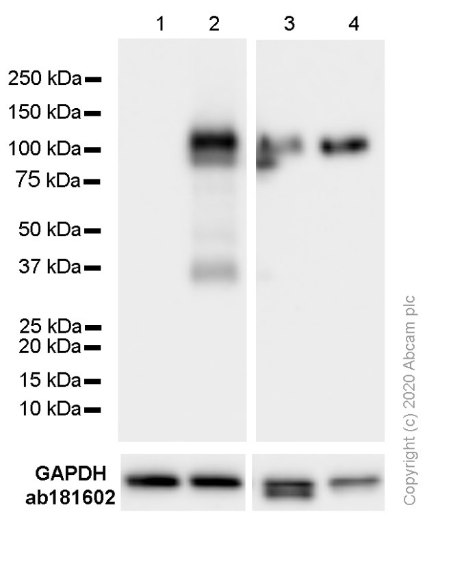 Western blot - Anti-VCAM1 antibody [EPR5038(2)] (AB174279), expandable thumbnail