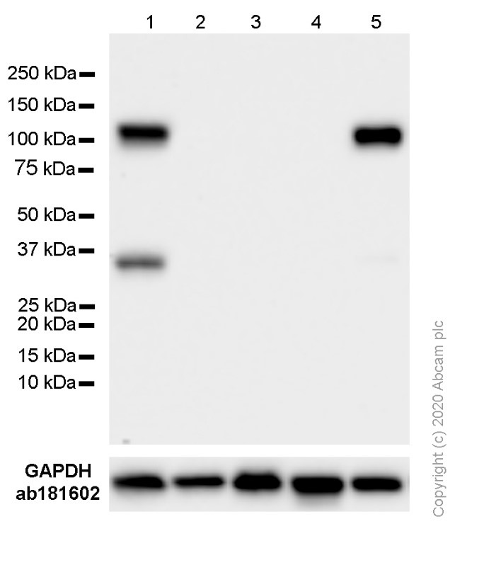 Western blot - Anti-VCAM1 antibody [EPR5038(2)] (AB174279), expandable thumbnail