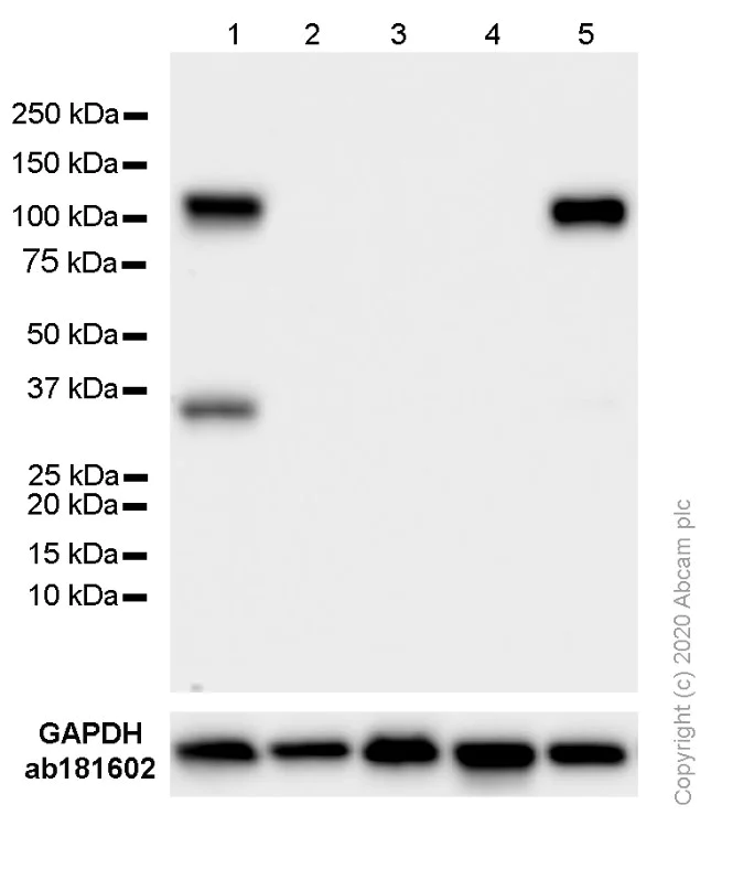 Western blot - Anti-VCAM1 antibody [EPR5038(2)] (AB174279)
