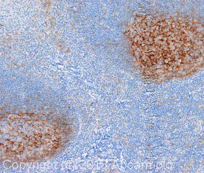 Immunohistochemistry (Formalin/PFA-fixed paraffin-embedded sections) - Anti-VCAM1 antibody [EPR5047] (AB134047)