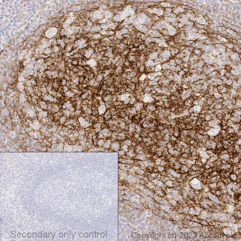 Immunohistochemistry (Formalin/PFA-fixed paraffin-embedded sections) - Anti-VCAM1 antibody [EPR5047] (AB134047)
