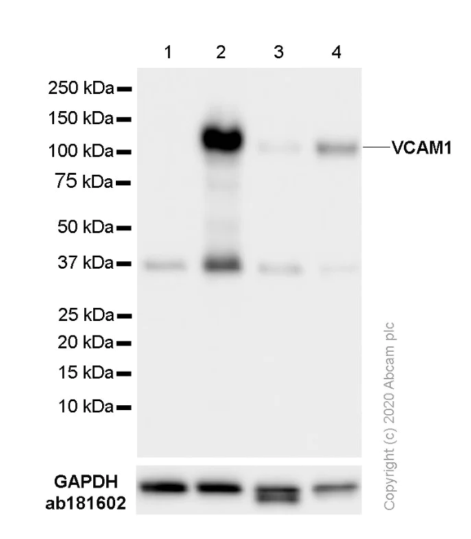Western blot - Anti-VCAM1 antibody [EPR5047] (AB134047)