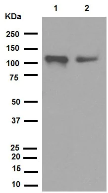 Western blot - Anti-VCAM1 antibody [EPR5047] (AB134047)