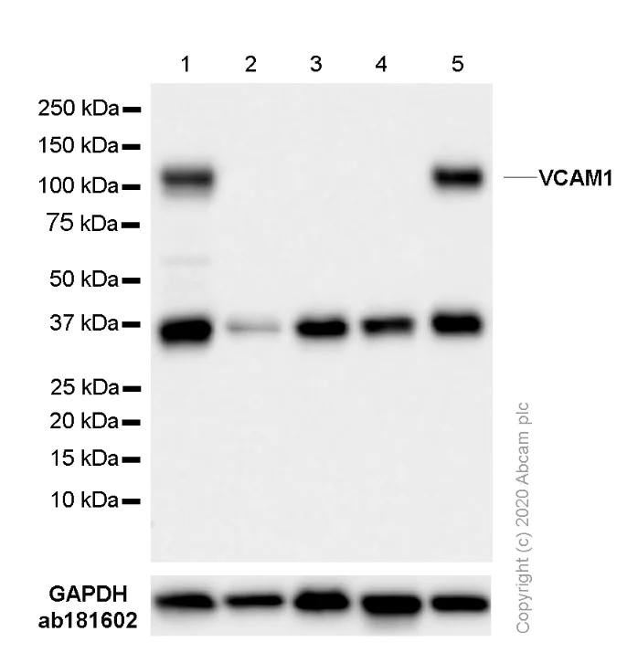 Western blot - Anti-VCAM1 antibody [EPR5047] (AB134047)