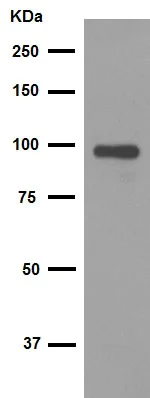Western blot - Anti-VCAM1 antibody [EPR5047] (AB134047)