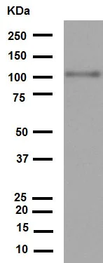 Western blot - Anti-VCAM1 antibody [EPR5047] (AB134047)