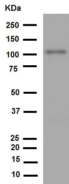 Western blot - Anti-VCAM1 antibody [EPR5047] (AB134047)