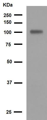 Western blot - Anti-VCAM1 antibody [EPR5047] (AB134047)