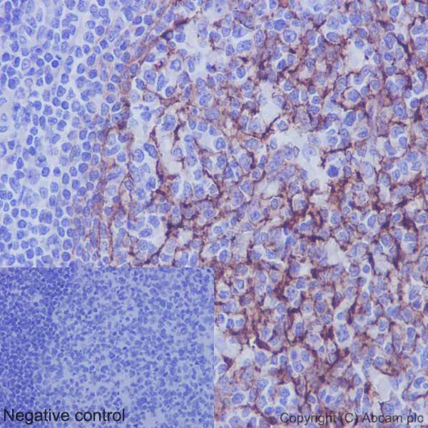 Immunohistochemistry (Formalin/PFA-fixed paraffin-embedded sections) - Anti-VCAM1 antibody [EPR5047] - BSA and Azide free (AB271899)